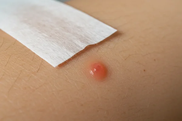 Avoid Waxing Skin Lifting: Your 2026 Guide