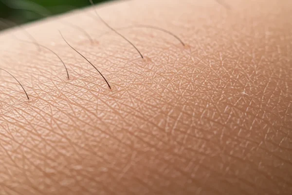 Post-Wax Breakouts: 5 DIY Fixes for 2026