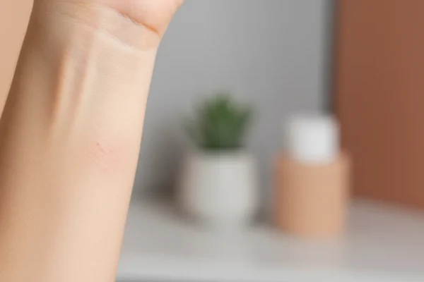 Laser Hair Removal: 5 Post-Care Risks in 2026